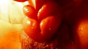 நீல வேனிட்டிஸ் Xxx
